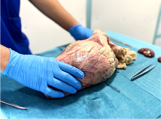 Medic holding human heart